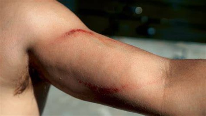 Can a catfish bite your finger off?