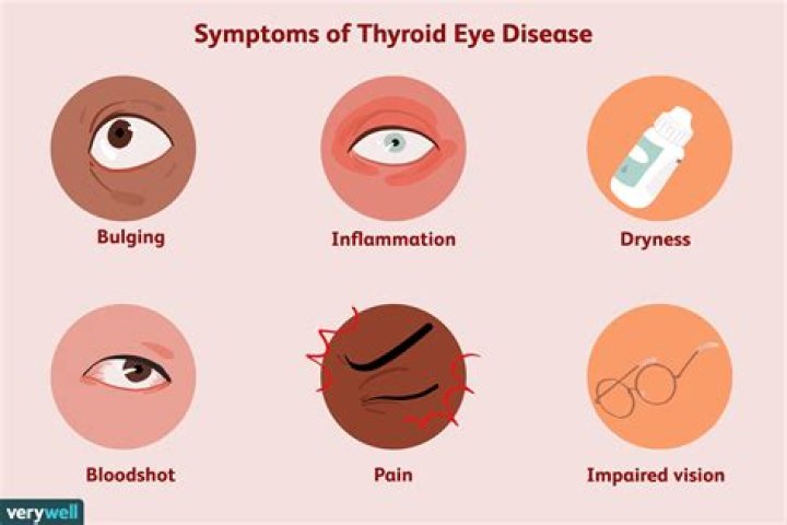 Can hypothyroidism affect eyesight?