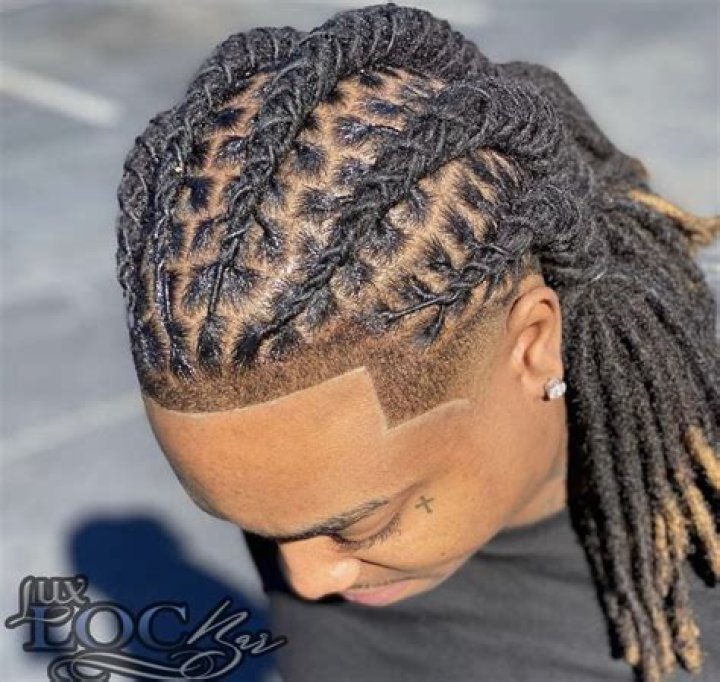 Do dreadlocks pull your hairline back?