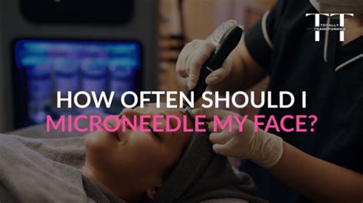 How long should I microneedle my face?