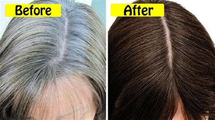 What color hair turns white with age?