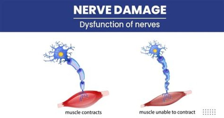 What does permanent nerve damage feel like?