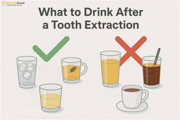 When can I start drinking hot coffee after tooth extraction?